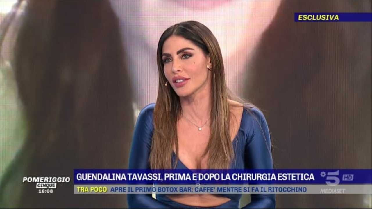 Guendalina Tavassi chirurgia