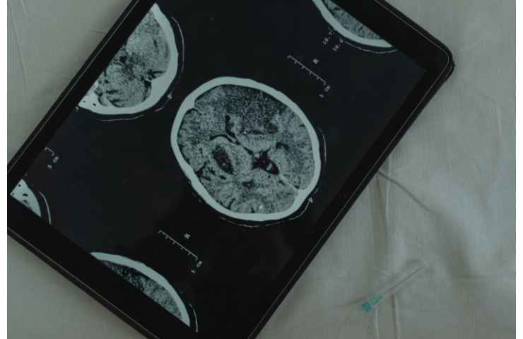 cervello umano esperimento uomo